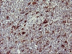 MMP13 Monoclonal Antibody (OTI2A6), TrueMAB , OriGene 100 &mu;L; Unconjugated:Antibodies,