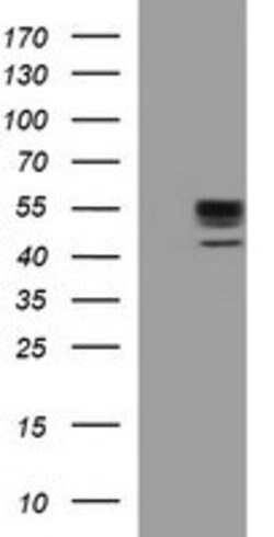 MMP13 Mouse anti-Human, Clone: OTI1G5, lyophilized, TrueMAB 100 &mu;g;