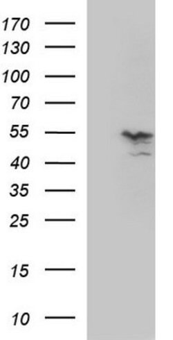 MMP13 Mouse anti-Human, Clone: OTI1F1, lyophilized, TrueMAB 100 &mu;g;
