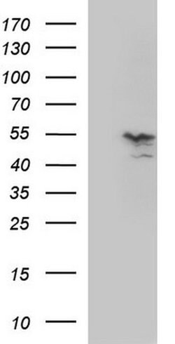 MMP13 Monoclonal Antibody (OTI1F1), TrueMAB , OriGene 100 &mu;L; Unconjugated:Antibodies,