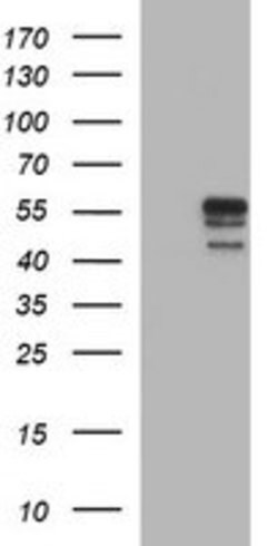 MMP13 Mouse anti-Human, Clone: OTI4B3, lyophilized, TrueMAB 100 &mu;g;