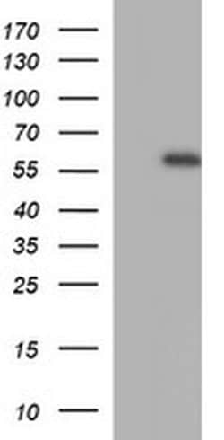 MMP13 Monoclonal Antibody (OTI2F4), TrueMAB , OriGene 30 &mu;L; Unconjugated:Antibodies,