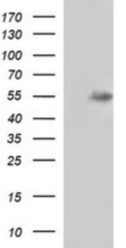 MMP13 Mouse anti-Human, Clone: OTI2D11, lyophilized, TrueMAB 100 &mu;g;