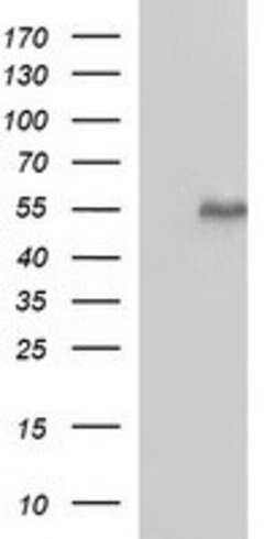 MMP13 Mouse anti-Human, Clone: OTI3F5, lyophilized, TrueMAB 100 &mu;g;