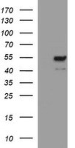 MMP13 Mouse anti-Human, Clone: OTI3G1, lyophilized, TrueMAB 100 μg;