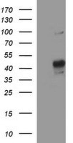 MMP13 Mouse anti-Human, Clone: OTI2A6, lyophilized, TrueMAB 100 &mu;g | Buy Online | Origene Technologies | Fisher Scientific