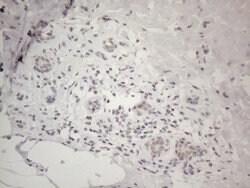 MMP2 Monoclonal Antibody (OTI4A11), TrueMAB , OriGene 100 &mu;L; Unconjugated:Antibodies,