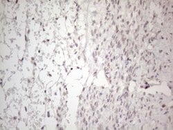 MMP2 Monoclonal Antibody (OTI4A11), TrueMAB , OriGene 100 &mu;L; Unconjugated:Antibodies,