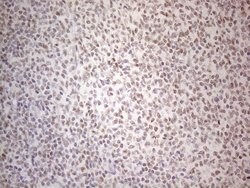 MMP2 Monoclonal Antibody (OTI4A11), TrueMAB , OriGene 100 &mu;L; Unconjugated:Antibodies,