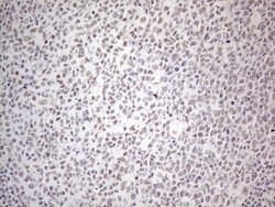 MMP2 Monoclonal Antibody (OTI4A11), TrueMAB , OriGene 100 &mu;L; Unconjugated:Antibodies,