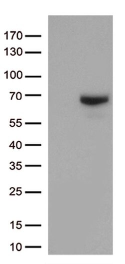 MMP2 Monoclonal Antibody (OTI4A11), TrueMAB , OriGene 100 &mu;L; Unconjugated:Antibodies,