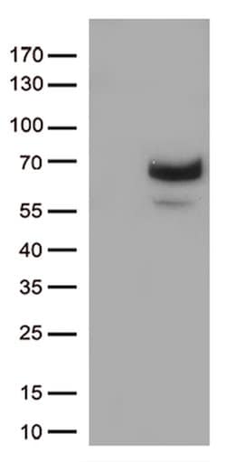 MMP2 Mouse anti-Human, Clone: OTI4B11, lyophilized, TrueMAB 100 &mu;g;