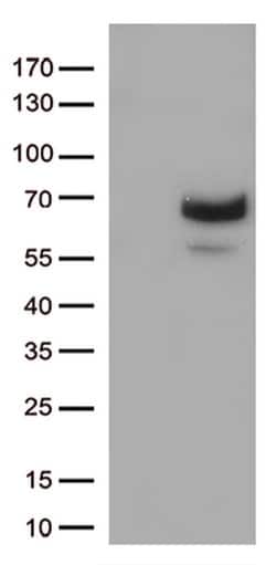 MMP2 Monoclonal Antibody (OTI4B11), TrueMAB , OriGene 30 &mu;L; Unconjugated:Antibodies,