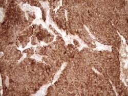 MMP3 Monoclonal Antibody (OTI1E9), TrueMAB , OriGene 30 &mu;L | Buy Online | Origene Technologies | Fisher Scientific