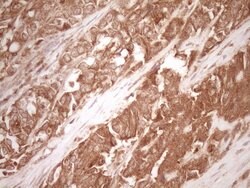 MMP3 Monoclonal Antibody (OTI1E9), TrueMAB , OriGene 30 &mu;L | Buy Online | Origene Technologies | Fisher Scientific