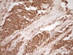 MMP3 Mouse anti-Human, Clone: OTI2D9, lyophilized, TrueMAB 100 &mu;g; Unconjugated:Antibodies,