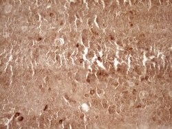 MMP3 Mouse anti-Human, Clone: OTI2D9, lyophilized, TrueMAB 100 &mu;g; Unconjugated:Antibodies,