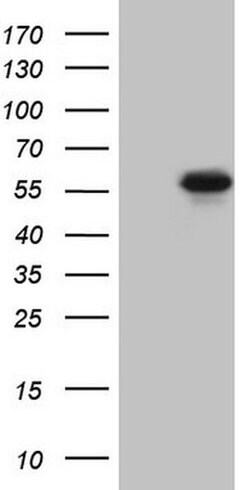 MMP3 Monoclonal Antibody (OTI4B5), TrueMAB , OriGene:Antibodies:Primary