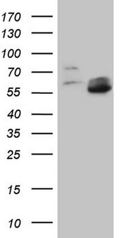 MMP3 Monoclonal Antibody (OTI1E9), TrueMAB , OriGene 30 &mu;L | Buy Online | Origene Technologies | Fisher Scientific
