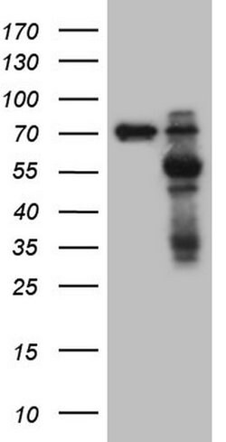 MMP3 Monoclonal Antibody (OTI2D6), TrueMAB , OriGene 100 &mu;L; Unconjugated:Antibodies,
