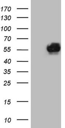 MMP3 Mouse anti-Human, Clone: OTI2D9, lyophilized, TrueMAB 100 &mu;g; Unconjugated:Antibodies,