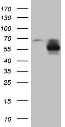 MMP3 Monoclonal Antibody (OTI3C6), TrueMAB , OriGene 100 &mu;L; Unconjugated:Antibodies,