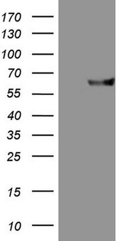 MMP3 Monoclonal Antibody (OTI2E7), TrueMAB , OriGene:Antibodies:Primary