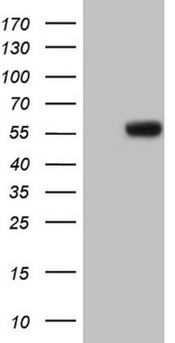 MMP3 Mouse anti-Human, Clone: OTI2D7, lyophilized, TrueMAB 100 &mu;g; Unconjugated:Antibodies,