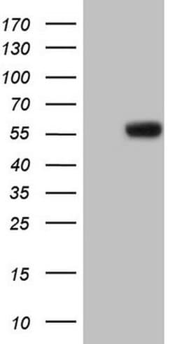 MMP3 Monoclonal Antibody (OTI2D7), TrueMAB , OriGene:Antibodies:Primary