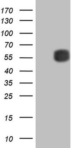 MMP3 Monoclonal Antibody (OTI2D4), TrueMAB , OriGene 100 &mu;L; Unconjugated:Antibodies,