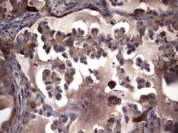 MMP7 Monoclonal Antibody (OTI3G7), TrueMAB , OriGene 100 &mu;L; Unconjugated:Antibodies,
