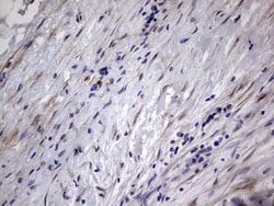MMP7 Monoclonal Antibody (OTI3G7), TrueMAB , OriGene:Antibodies:Primary