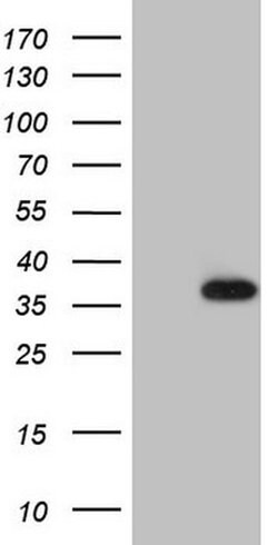 MMP7 Monoclonal Antibody (OTI2E1), TrueMAB , OriGene 100 &mu;L | Buy Online | Origene Technologies | Fisher Scientific