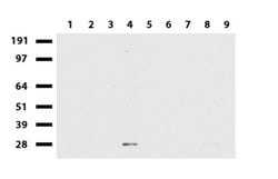 MMP7 Mouse anti-Human, Clone: UMAB168, liquid, UltraMAB 100 &mu;L | Buy Online | Origene Technologies | Fisher Scientific