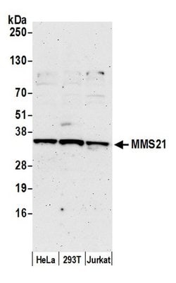 MMS21 Rabbit anti-Human, Polyclonal, Bethyl Laboratories 10 &mu;L | Buy Online | Bethyl Laboratories, Inc | Fisher Scientific
