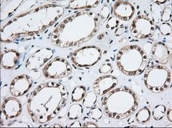 MOBKL1A Monoclonal Antibody (OTI3G9), TrueMAB , OriGene:Antibodies:Primary
