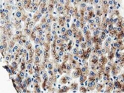 MOBKL1A Monoclonal Antibody (OTI1H2), TrueMAB , OriGene 100 μL; Unconjugated:Antibodies,