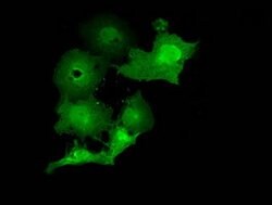 MOBKL2B Mouse anti-Human, Clone: OTI1G1, lyophilized, TrueMAB 100 &mu;g;