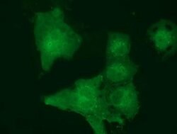 MOBKL2B Monoclonal Antibody (OTI6C6), TrueMAB , OriGene 100 &mu;L; Unconjugated:Antibodies,