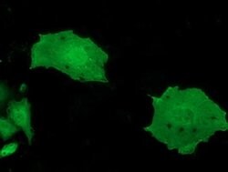 MOBKL2B Monoclonal Antibody (OTI2H8), TrueMAB , OriGene 100 &mu;L; Unconjugated:Antibodies,
