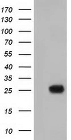 MOBKL2B Monoclonal Antibody (OTI6C6), TrueMAB , OriGene:Antibodies:Primary