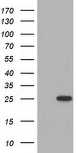 MOBKL2B Monoclonal Antibody (OTI7G2), TrueMAB , OriGene 30 &mu;L; Unconjugated:Antibodies,