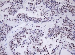 MORF4 Monoclonal Antibody (OTI5F2), TrueMAB , OriGene:Antibodies:Primary