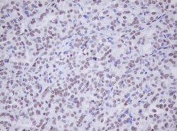 MORF4 Mouse anti-Canine, Human, Mouse, Rat, Clone: OTI5F2, lyophilized, TrueMAB 100 &mu;g | Buy Online | Origene Technologies | Fisher Scientific