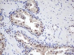 MORF4 Monoclonal Antibody (OTI1B12), TrueMAB , OriGene 100 &mu;L; Unconjugated:Antibodies,