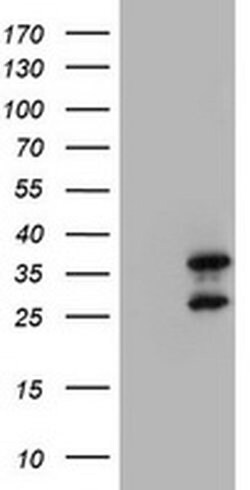MORF4 Monoclonal Antibody (OTI5E6), TrueMAB , OriGene 100 &mu;L; Unconjugated:Antibodies,