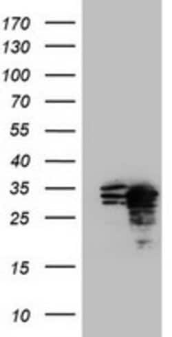 MORF4 Mouse anti-Human, Clone: OTI2E4, lyophilized, TrueMAB 100 &mu;g;