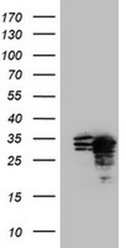 MORF4 Monoclonal Antibody (OTI2E4), TrueMAB , OriGene:Antibodies:Primary