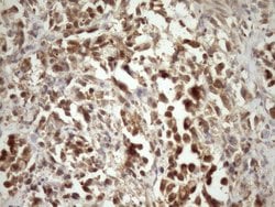 MORF4L1 Monoclonal Antibody (OTI5D2), TrueMAB , OriGene:Antibodies:Primary