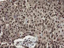 MPI Mouse anti-Human, Clone: OTI4G7, lyophilized, TrueMAB 100 &mu;g; Unconjugated:Antibodies,